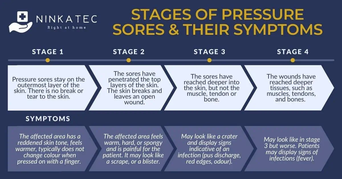 https://ninkatec.b-cdn.net/wp-content/uploads/2020/03/Ninkatec_Stages-of-Pressure-Sores-Their-Symptoms.jpg