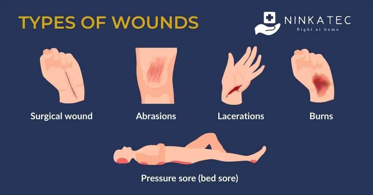 Ninkatec_a caregiver guide to wound care at home_types of wounds